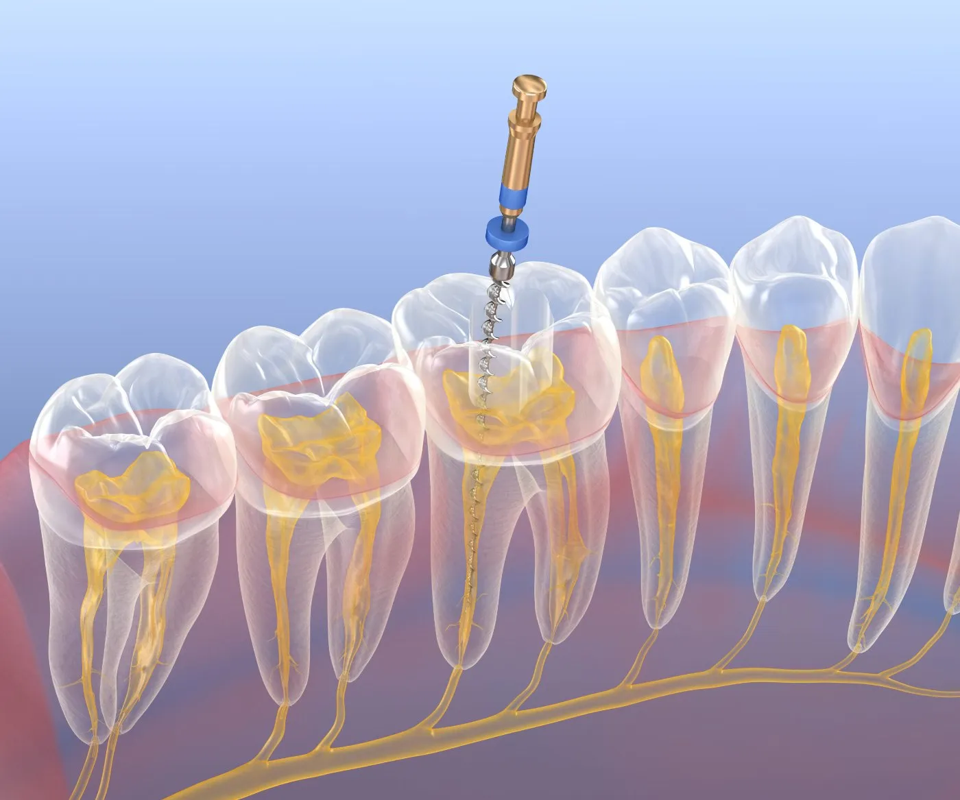 3D diagnostika CBCT